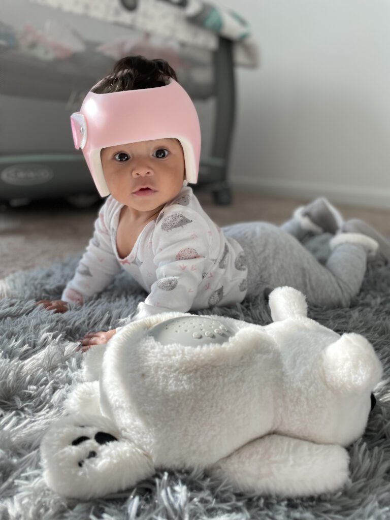Cranial Helmets for babies